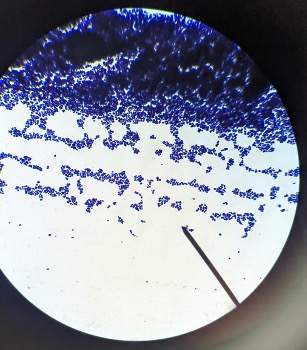 gram stained bacteria under the microscope